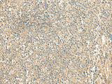 Immunohistochemistry of paraffin-embedded Human tonsil tissue using LMO3 Polyclonal Antibody at dilution of 1:50(×200)