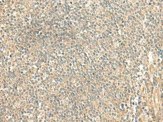 Anti-Human/Mouse/Rat LMO3 Antibody