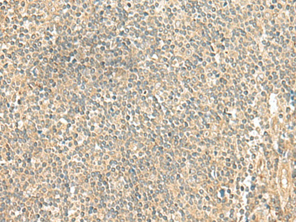 Immunohistochemistry of paraffin-embedded Human tonsil tissue using LMO3 Polyclonal Antibody at dilution of 1:50(×200)