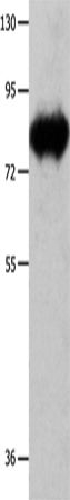 Anti-Human/Mouse/Rat ECE1 Antibody - ABMIUM