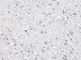 Immunohistochemistry of paraffin-embedded Human brain tissue using METTL7A Polyclonal Antibody at dilution of 1:40(×200)