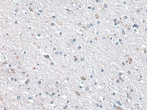 Immunohistochemistry of paraffin-embedded Human brain tissue using METTL7A Polyclonal Antibody at dilution of 1:40(×200)