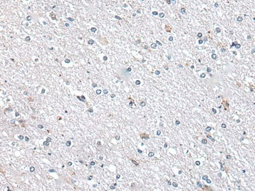 Immunohistochemistry of paraffin-embedded Human brain tissue using METTL7A Polyclonal Antibody at dilution of 1:40(×200)