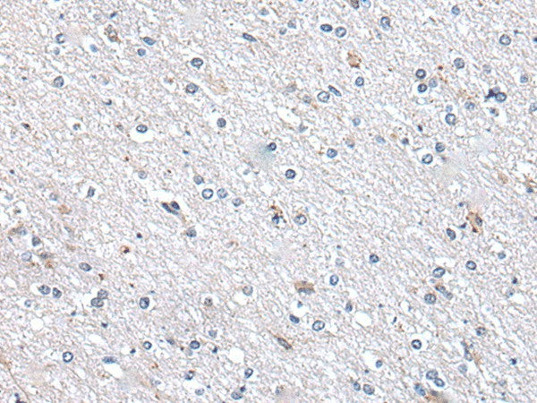 Immunohistochemistry of paraffin-embedded Human brain tissue using METTL7A Polyclonal Antibody at dilution of 1:40(×200)