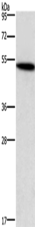 Anti-Human/Mouse/Rat SMAD3 Antibody - ABMIUM