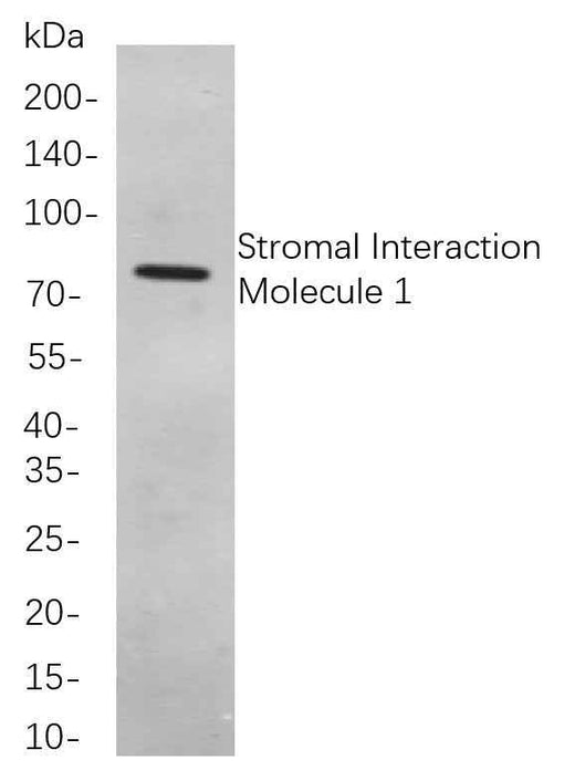 Anti-Human/Mouse/Rat Stromal Interaction Molecule 1 Antibody [B743] - ABMIUM