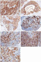 Anti-Human WFDC2 Antibody [B353]