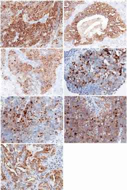 Anti-Human WFDC2 Antibody [B353] - ABMIUM