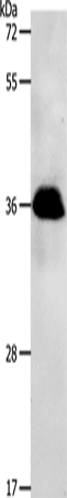 Anti-Human/Mouse/Rat PPP2CB Antibody - ABMIUM