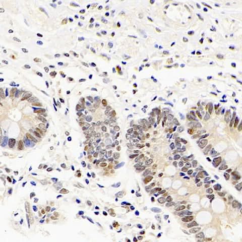 Immunohistochemistry analysis of paraffin-embedded human stomach using Mineralocorticoid receptor Polyclonal Antibody at dilution of 1:300.