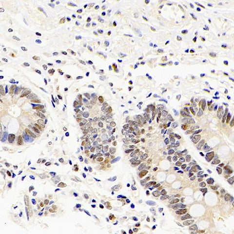 Immunohistochemistry analysis of paraffin-embedded human stomach using Mineralocorticoid receptor Polyclonal Antibody at dilution of 1:300.