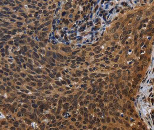 Anti-Human FHL3 Antibody