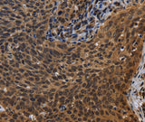 Anti-Human FHL3 Antibody - ABMIUM