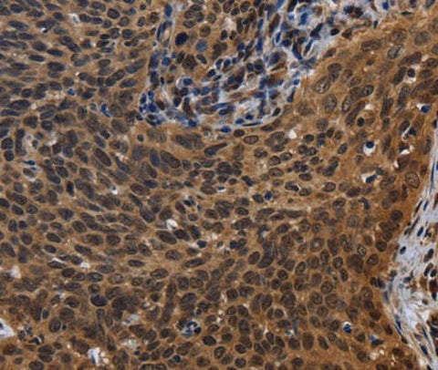 Anti-Human FHL3 Antibody - ABMIUM