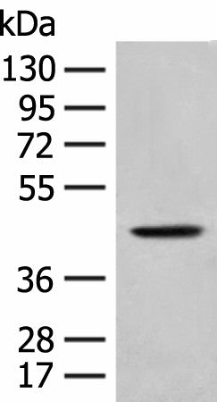 Anti-Human HLA-B Antibody - ABMIUM