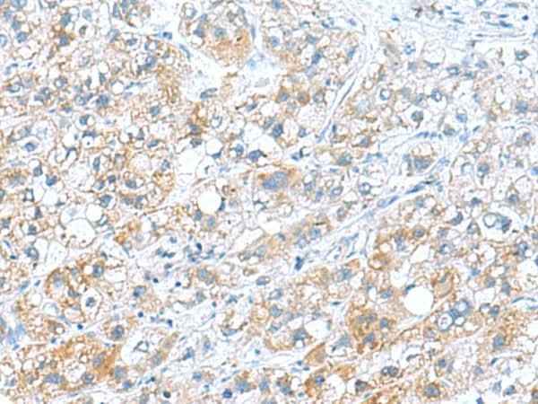 Anti-Human/Mouse/Rat DNAL1 Antibody