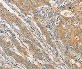 Anti-Human/Mouse STAM Antibody - ABMIUM
