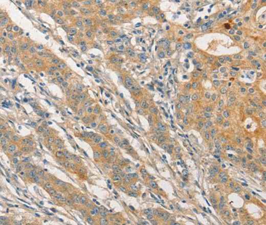 Anti-Human/Mouse STAM Antibody