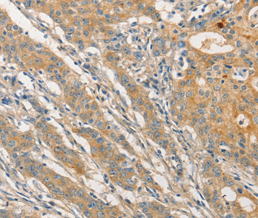 Anti-Human/Mouse STAM Antibody - ABMIUM