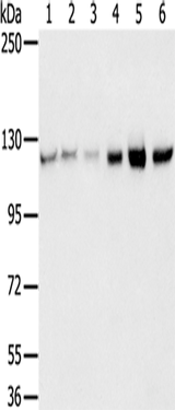 Anti-Human/Mouse/Rat RBM5 Antibody - ABMIUM