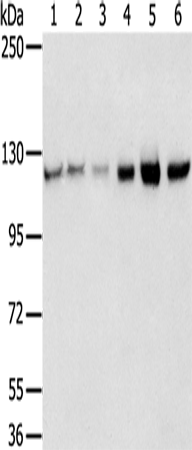 Anti-Human/Mouse/Rat RBM5 Antibody - ABMIUM