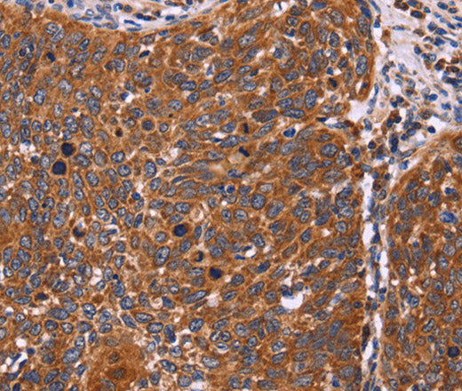 Anti-Human/Mouse FBXW7 Antibody - ABMIUM
