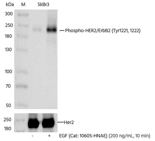 Anti-Human ERBB2 Antibody [A1115] - ABMIUM
