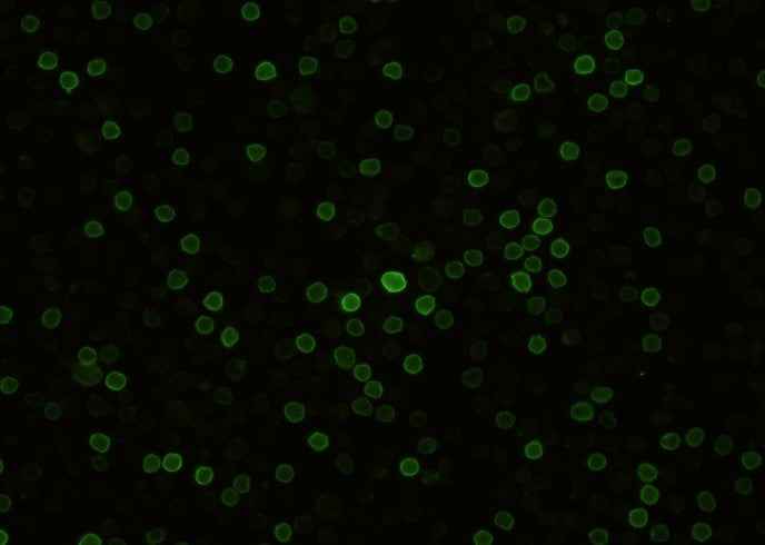 Anti-Mouse CD27 Antibody [B406] - ABMIUM