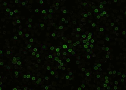 Anti-Mouse CD27 Antibody [B406] - ABMIUM
