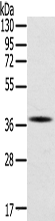 Anti-Human/Mouse/Rat SPARC Antibody - ABMIUM
