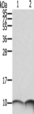 Anti-Human/Mouse/Rat S100A6 Antibody - ABMIUM