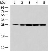 Western blot analysis of 293T Jurkat and A375 cell lysates using PSMA6 Polyclonal Antibody at dilution of 1:900