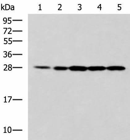 Western blot analysis of 293T Jurkat and A375 cell lysates using PSMA6 Polyclonal Antibody at dilution of 1:900