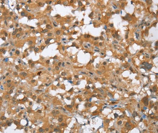 Anti-Human MMP12 Antibody - ABMIUM