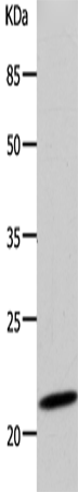 Anti-Human/Rat DUT Antibody - ABMIUM