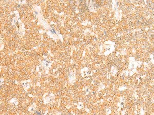 Anti-Human/Mouse/Rat RRP8 Antibody