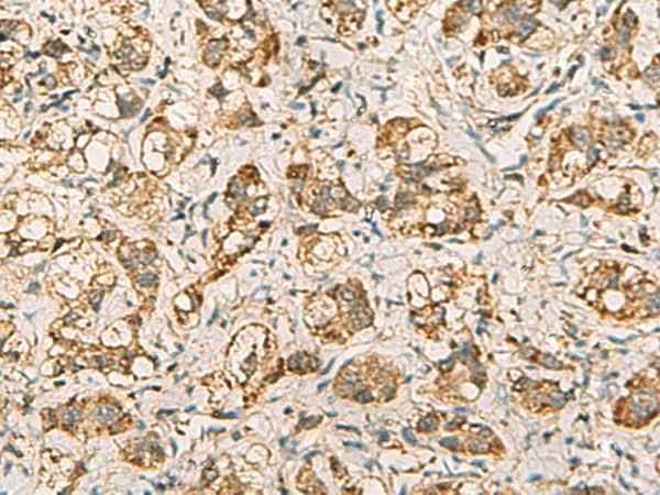Anti-Human/Mouse VTA1 Antibody
