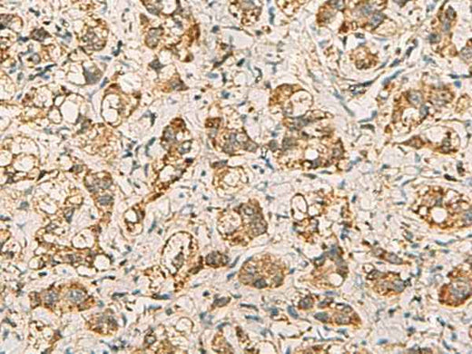 Anti-Human/Mouse VTA1 Antibody