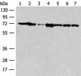 Western blot analysis of Mouse brain tissue Human cerebrum tissue NIH/3T3 cell A549 cell Jurkat cell Hela cell and 231 cell lysates using HSPA2 Polyclonal Antibody at dilution of 1:250