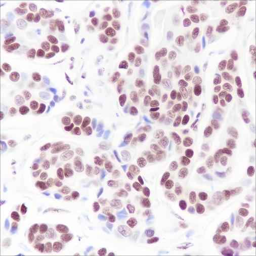 Anti-Human/Rat/Mouse SETD1A Antibody [A256]