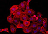 Anti-Human CCR2 Antibody - ABMIUM