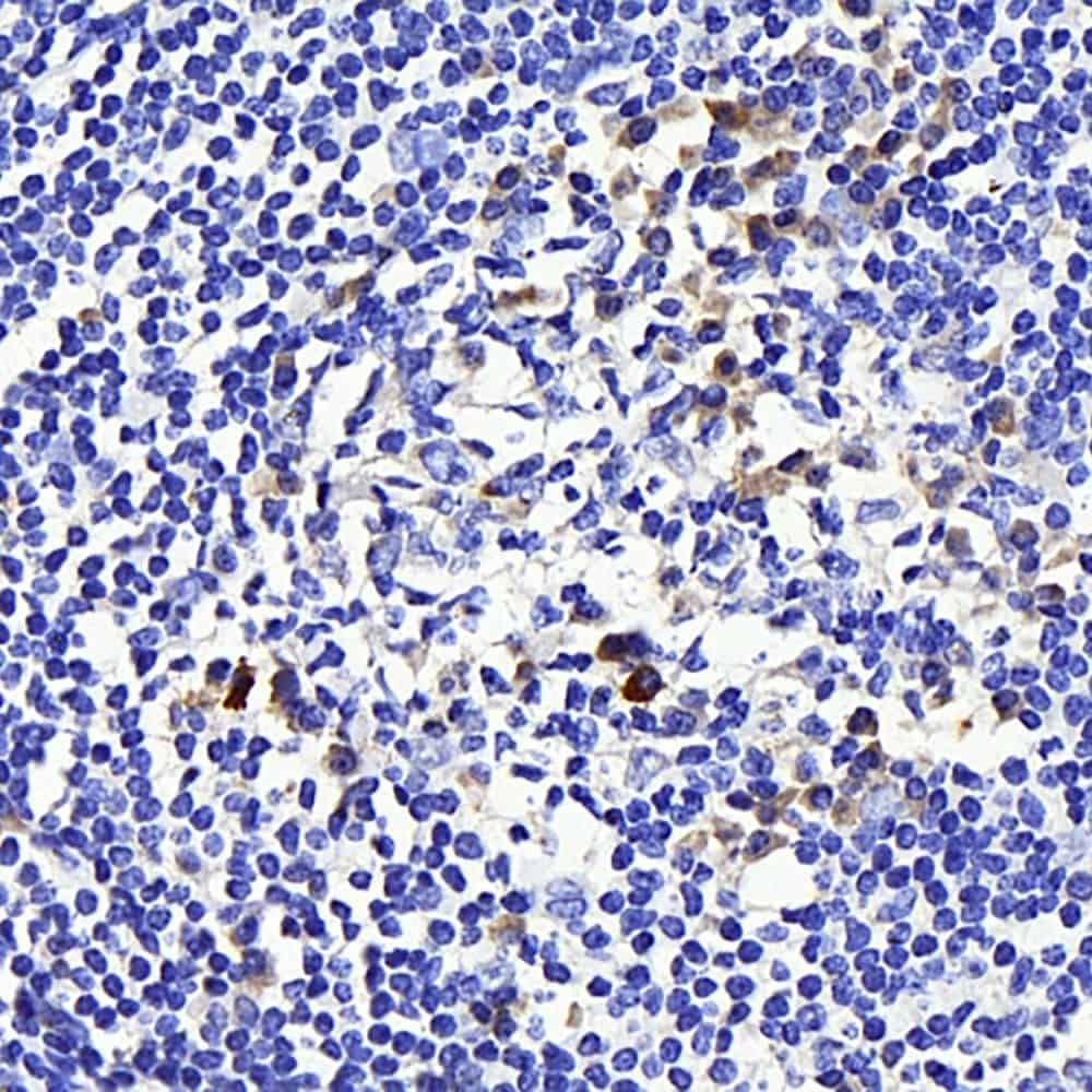 Immunohistochemistry analysis of paraffin-embedded human tonsil using CD169 Polyclonal Antibody at dilution of 1:300.