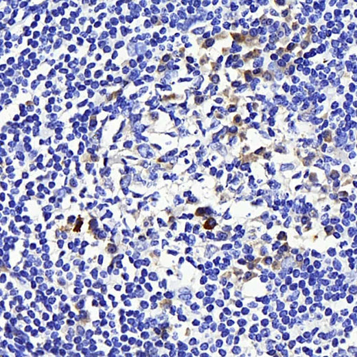 Immunohistochemistry analysis of paraffin-embedded human tonsil using CD169 Polyclonal Antibody at dilution of 1:300.