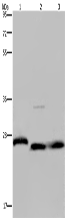 Anti-Human/Mouse/Rat GSTP1 Antibody - ABMIUM