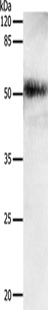 Anti-Human/Mouse EDA Antibody - ABMIUM