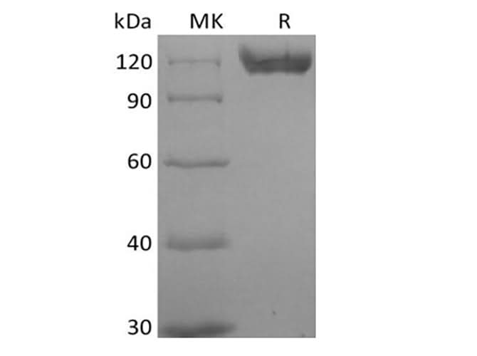 Recombinant Human B-cell Receptor CD22/Siglec-2/CD22 (C-6His) Biotinylated - ABMIUM