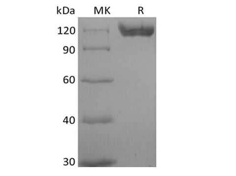 Recombinant Human B-cell Receptor CD22/Siglec-2/CD22 (C-6His) Biotinylated - ABMIUM