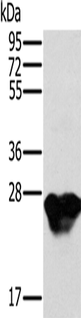 Anti-Human/Mouse/Rat MYL3 Antibody - ABMIUM