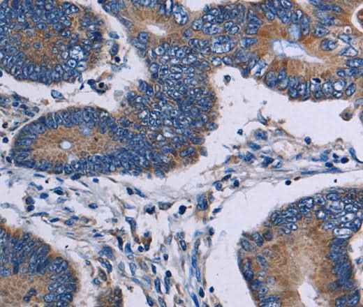 Anti-Human/Mouse ITK Antibody