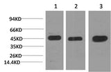 Western Blot analysis of 1) Hela, 2) 3T3, 3) Rat brain using MAP2K2 Monoclonal Antibody at dilution of 1:2000.